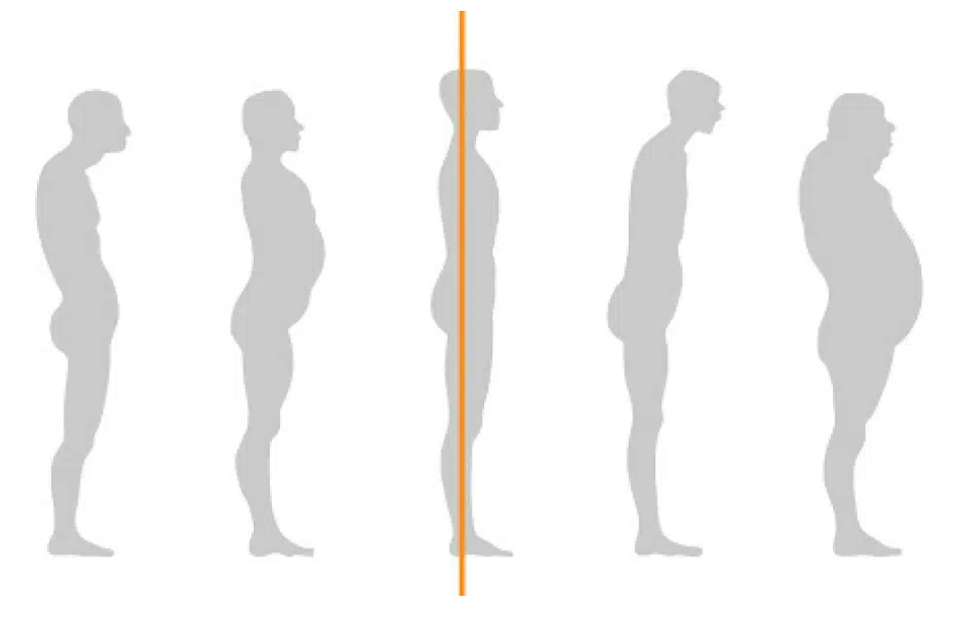 5 silhouettes compare types of bad posture with good posture.